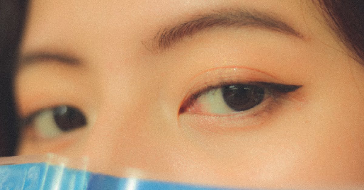 Swollen Eyes from Allergies: Causes, Treatments, and Prevention